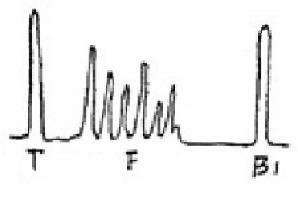 超声检测中常见缺陷的波形的图文介绍